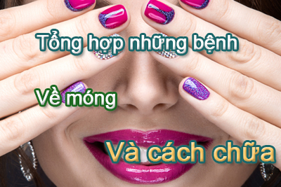 Tổng hợp những bệnh về móng và cách chữa – Thợ Nails nên đọc kỹ