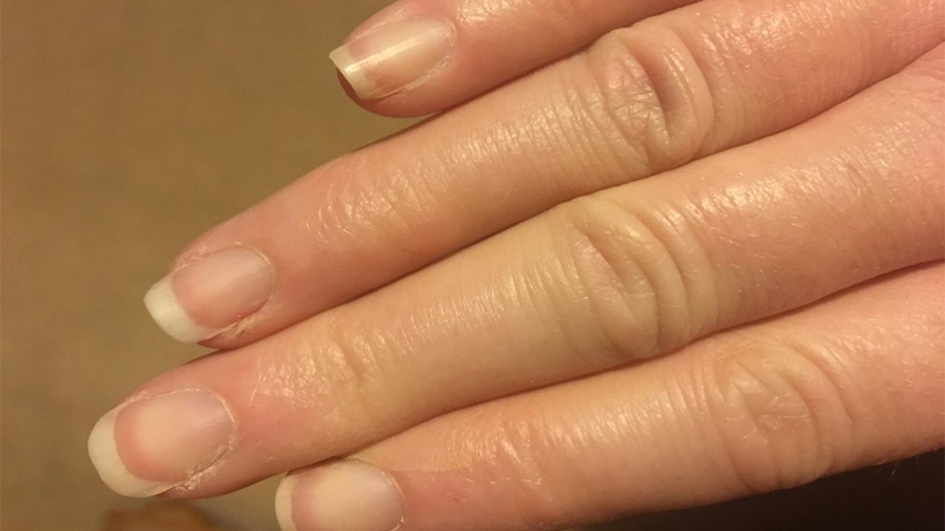 fingernails-and-health-signs-10-Signs-that-could-be-showing-you-underlying-health-problems-1