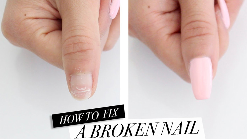 nail-repairs-and-what-are-nail-repair-costs-associated-with-them-1
