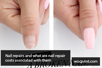 Nail repairs and what are nail repair costs associated with them